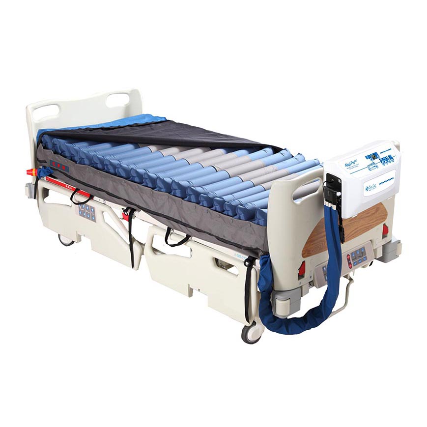 alternating pressure enhanced low air loss mattress system