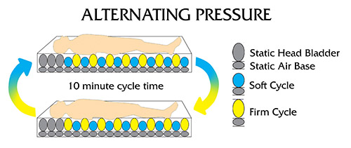 alternating pressure mattress