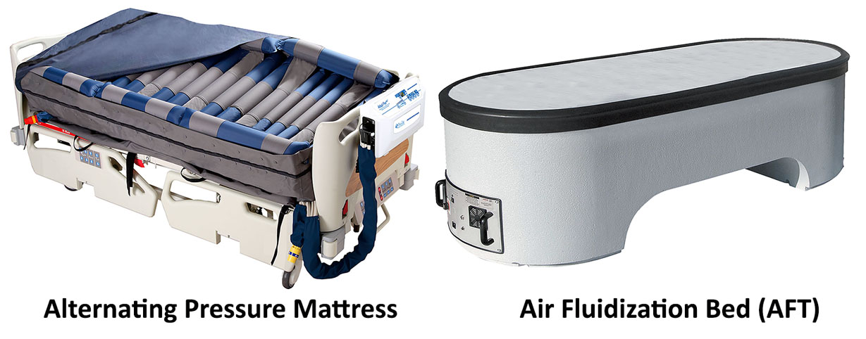 alternating pressure mattress vs aft bed