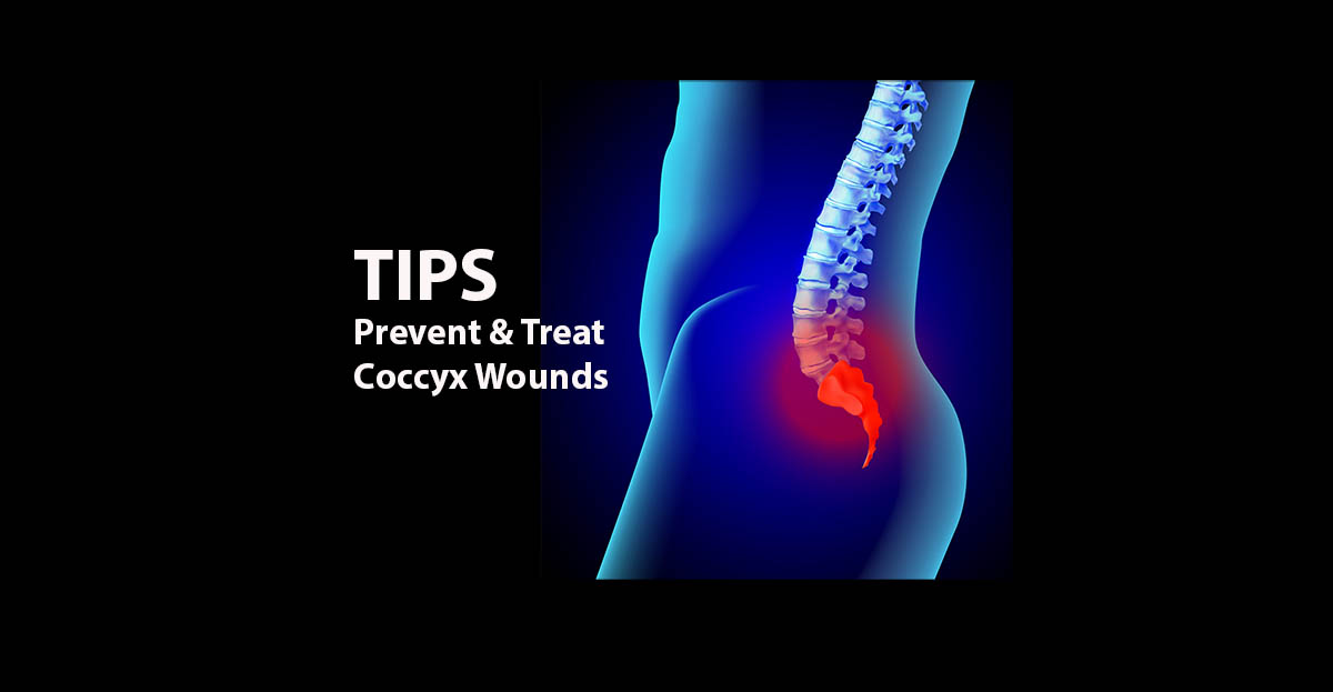 prevent and treat coccyx wounds