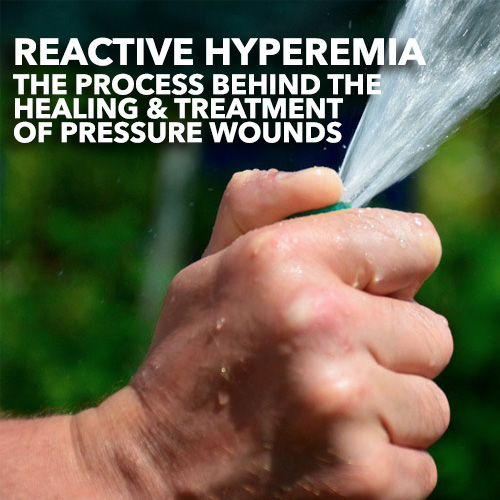 reactive hyperemia